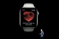 Elettrocardiogramma Apple Watch