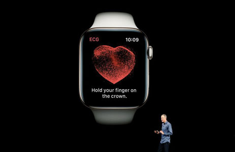 Elettrocardiogramma Apple Watch